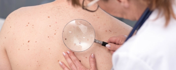 Endométriose et cancers cutanés